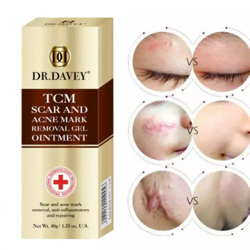 DR.DAVEY tcm scar and acne mark removal gel ointment 40g