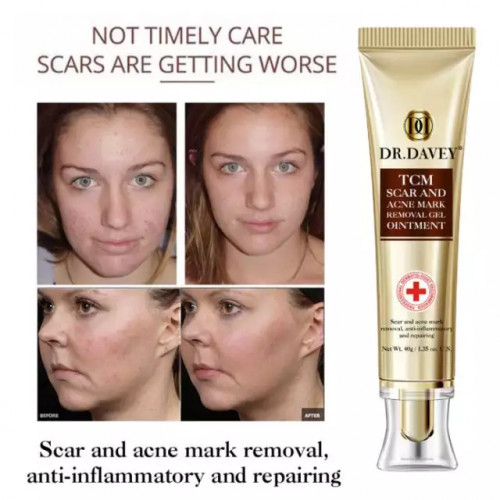 DR.DAVEY tcm scar and acne mark removal gel ointment 40g