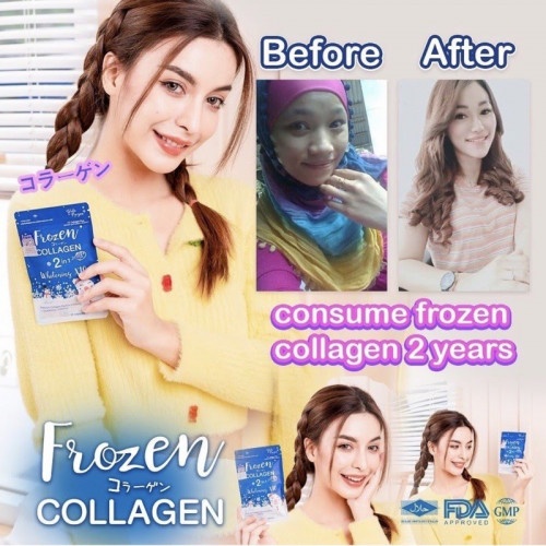 Frozen Collagen 2 in 1