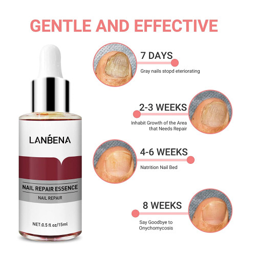 LANBENA Nail Repair Essence,