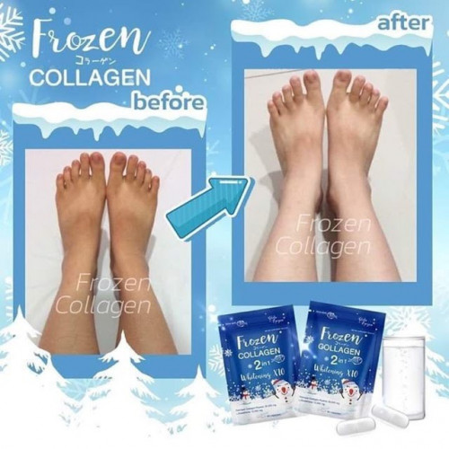 Frozen Collagen 2 in 1