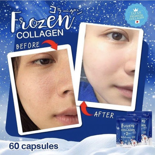 Frozen Collagen 2 in 1