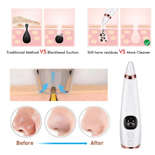 Pore Cleaner Blackhead Remover Vacuum Electric Nose Face Deep Cleansing Skin Care Machine
