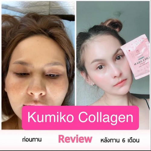 Kumiko Collagen Tripeptide