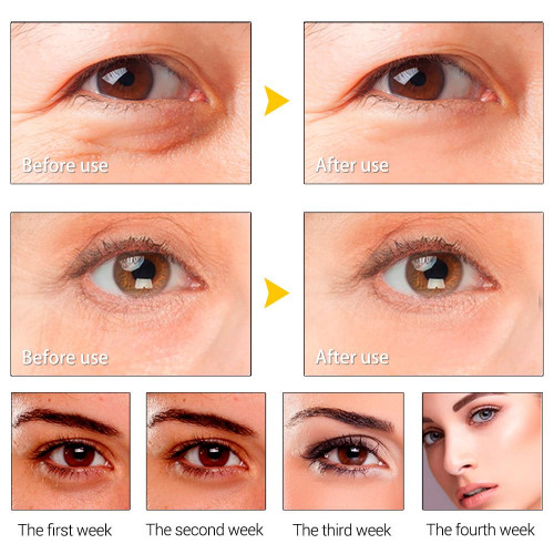LANBENA Peptide Wrinkle Eye Serum Anti-Puffiness Dark Circle Anti-Aging Moisturizing Eye Care 