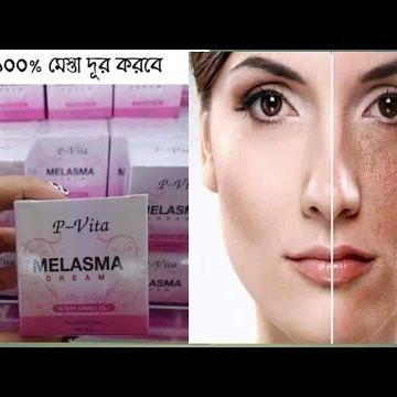P-Vita Melasma Cream-airdeal (IMPORTED)